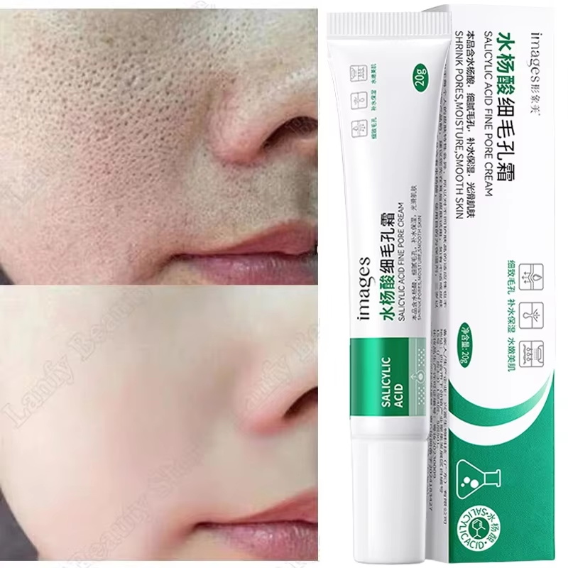 كريم حمض الساليسيليك لتنظيف ال - مراجعة Salicylic Acid Blackhead Remover وسعره